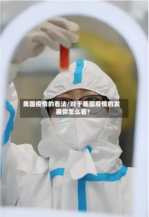 美国疫情的看法/对于美国疫情的发展你怎么看?