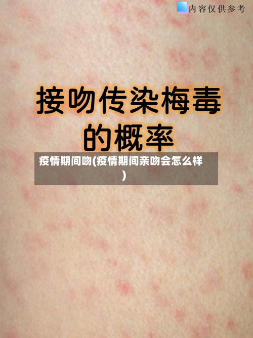 疫情期间吻(疫情期间亲吻会怎么样)