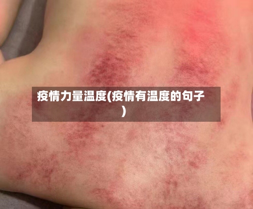 疫情力量温度(疫情有温度的句子)